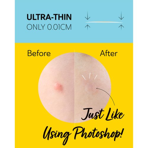 DERMA ANGEL Ultra Invisible Cystic Acne Patches for Cystic Acne Treatment Acne Patches for Cystic Acne Blemish Patches Hydrocolloid Patches -Day and Night- UPGRADED (Acne Specialist-120 Count-3 Sizes)