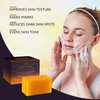 VALITIC Kojic Acid Vitamin C and Retinol Soap Bars with Turmeric for Dark Spot - Original Japanese Complex Infused with Collagen, Hyaluronic Acid, and Vitamin E (2 Pack)