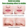 LOVEMIN Green Tea Blackhead Remover Mask Stick for Face, Deep Cleansing, Poreless Skin Treatment, Unisex
