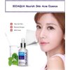 BIOAQUA 3in1 Face Acne Scar Removal Spots Oil Cream Scar Blemish Marks Moisturizing Oil 100g+30g+30ml