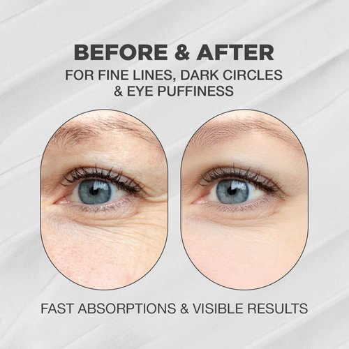 Snail Eye Cream | Advanced Snail Mucin Eye Cream | Snail Mucin Eye Cream | Snail Mucin Eye Cream with High Concentrate of Snail Secretion Filtrate | Snail Eye Cream with Natural and Innovative Complex | Korean Moisturizer Snail Eye Cream with 96% Snail Mu