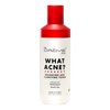 The Creme Shop WHAT ACNE? Balancing And Clarifying Toner Infused With With Hazel, Green Tea Made In Korea