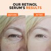 +1HEROLABS Retinol Serum for Face 2.5%, B5 Resurfacing Retinol Serum with Vitamin C, Vitamin E, Hyaluronic Acid, Serum for Anti-Aging, Wrinkle Smoothing, Dark Spot Corrector, Brighten Dullness