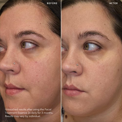 SK-II Facial Treatment Essence - Anti-Aging Essence Skincare to Help Reduce The Appearance of Fine Lines & Wrinkles - Visibly Refines Texture & Improves Firmness & Dark Spots (2.5 oz)