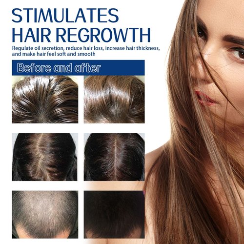 Rosemary Scalp Scrub Exfoliator Shampoo, Treatment for Dandruff Dry Itchy Scalp Hair Loss, Oil Control Clarifying Shampoo for Build Up, Fresh Soothe Scalp Sulfate-Free, 3.52oz