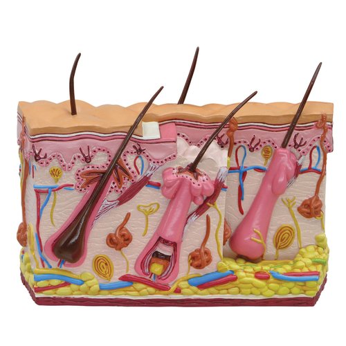 GPI Anatomicals - Skin Acne Model, Cross-Section Showing Normal and Common Acne-Riddled Skin for Human Anatomy, Physiology Education, Anatomy Model for Doctor's Office, Medical Learning Resources