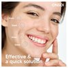 ONSOI 150 Blemish Patch - Hydrocolloid Pimple Patches for Face, Acne Spot Treatment-Cica