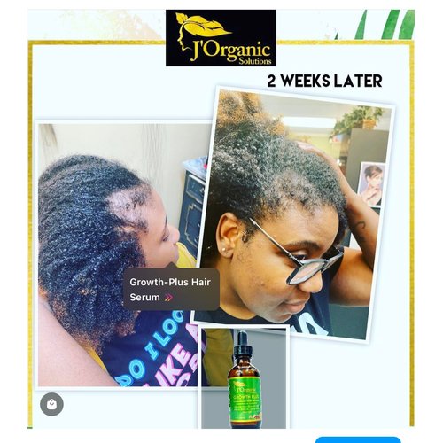 J'Organic Solutions Growth-Plus Scalp Nourishing Oil 4 Oz