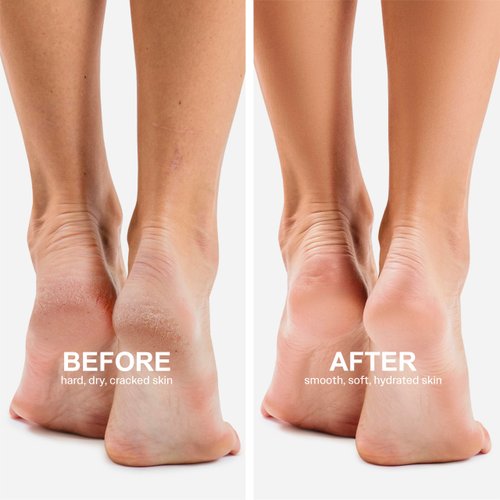 Innerest Original Derma Beauty Foot Mask 6 Pairs Shea Butter Foot Mask Callus Remover Pedicure Supplies