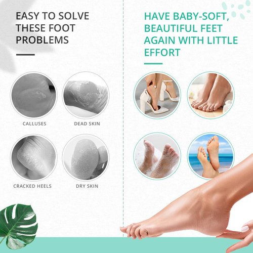 IAPPADORE 2 Packs Foot Files, Professional Double-Sided Callus Remover Foot Rasp, Surgical Stainless Steel Foot Scrubber for Wet Dry Feet, Foot Grater Tool with Handle for Smooth Feet