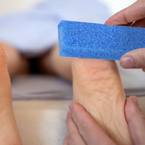 Batiyeer 100 Pcs Pumice Stone for Feet Scrubber Dead Skin Disposable Foot Pumice Foot Shower Scrubber Foot Scrubber for Heel Cuticle Callus Remover Bath Spa (Blue)