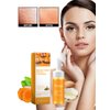 RETZLA Turmeric Facial Cleanser, Turmeric Facial Wash, Turmeric Face Wash, Deep cleansing of facial skin,Turmeric Foaming Cleanser for All Skin