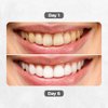 Puur Smile Teeth Whitening Gel Pen - Best Teeth Whitening Kit with Gel Pen Teeth Whitener 30+ Uses, Effective, Painless, No Sensitivity, Beautiful White Smile