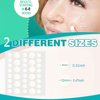 CGBOOM 216 PCS Acne Pimple Master Patches,1.5% Salicylic Acid and Niacinamide, Spot & Blemish Treatment Stickers Invisible Hydrocolloid Patches, 2 Sizes （8mm, 12mm）