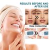 16PCS Aloe Vera Gel for Face and Body,Hydrating Aloe Vera Gel,Cooling Refreshing After Sun Lotion,Soothing Non-Sticky After Sun Lotion Set,Travel Size Body Skincare Cream, 1.05 Oz