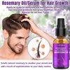 Rosemary Oil Hair Growth Serum with Biotin,Castor Oil Hair Growth Conditioner,Scalp & Thinning Hair Loss Treatment for Smoother,Thicker,Fuller Hair