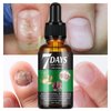 Ginger Cuticle Oil for Nails, Nail Nutrient Oil Strengthener Oil Serum Turmeric Nail Growth Oil for Damaged Nails Thin Nails Cuticle Repair Nourishing Moisturizing and Clear Texture, Non-sticky