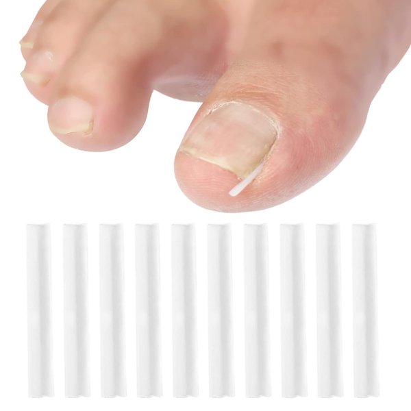 10 Pcs White Ingrown Toenail Correction Strips Brace Kit,Toenails Thick Pedicure Tool Toenail Straightener Strip for Men Women Foot Care Tool,Nail Tools,Ingrown Toenail Corrector,Ingrown Toenail Tools