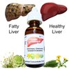 Liver Support Cleanse Fatty Liver Purifier Detox Herbal Concentrate Drops Pure Organic Artichoke Dandelion Chamomile & Horsetail