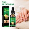 2PCS Ginger Nail Treatment, 7 Days Ginger Nail Treatment, Nail Oil Serum Ginger Nail Growth Oil