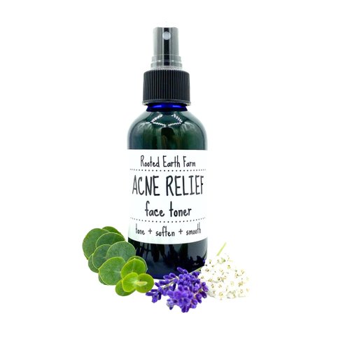 Acne Relief Face Toner - 4 fl oz - for Clear Skin - Natural Astringent