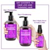 Hair Growth Shampoo and Conditioner Set W/Rosemary Oil Hair Growth Serum,Biotin Argan Oil Castor Oil Coconut Keratin Shampoo for Thinning Hair and Hair Loss,Deep Conditioner for Dry Damaged Curly Hair