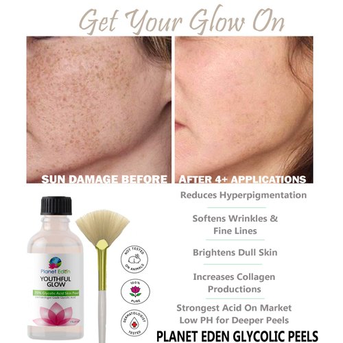 Planet Eden 70% Glycolic Acid Chemical Skin Peel Kit with Hyaluronic Acid + 2.5% Retinol Serum and Fan Brush