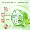 DISAAR Beauty Aloe Vera Anti-Acne Gel Cream Mass Sleep-Free Wash Moisturizing Oil 300ml