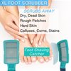 Onyx Professional Curved Foot File + Callus Remover, XL Double-Sided Ergonomic Pedicure File & Stainless Steel Foot Rasp, Effective Foot Exfoliator & Dead Skin Remover for Softer, Smoother Feet