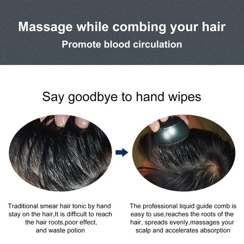 mriya Scalp Applicator Comb, Hair Oil Applicator for Medicine Scalp Head Fluid Comb Essential Oil Hair Treatment Head Scalp Massager Brush Hair Growth