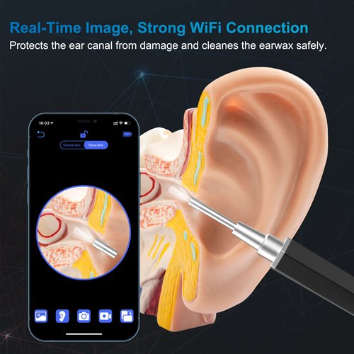 Ear Wax Removal, Ear Cleaner with Camera Earwax Remover Tool, Ear Camera Otoscope kit with Light, Ear Wax Camera with 6 Ear Spoon for Kids, Adults & Pets