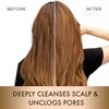 MOEHAIR Clarifying Shampoo | Deep Detox Shampoo | Cleanses Dirt, Dust & Scalp Buildup | Adds Shine | Removes Residues & Improves Scalp Health | Paraben & sulfate-free shampoo (12 Fl. Oz)
