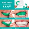 Opalescence Go 10- Prefilled Teeth Whitening Trays Kit- 10% Hydrogen Peroxide - (10 Treatments) - Mint Made by Ultradent Products. Go Teeth Whitening Kit -Mint- GO10-5193-1