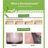 Black Mask, Blackhead Peel Off Mask, Black Mud Deep Cleansing Peel Off Acne Mask Activated Charcoal Tearing Mask for Face Nose (50ml)