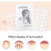 JJLFresheners Lady 72Pcs Pimple Patch Safe Fast Absorption Compact Quick Invisible Acne Patch for Women Pimple Patch Cover Acne, Treatments and Masks, Pore Cleansing Strips