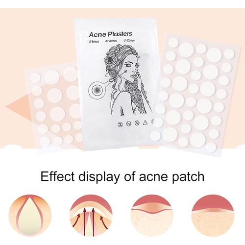 JJLFresheners Lady 72Pcs Pimple Patch Safe Fast Absorption Compact Quick Invisible Acne Patch for Women Pimple Patch Cover Acne, Treatments and Masks, Pore Cleansing Strips
