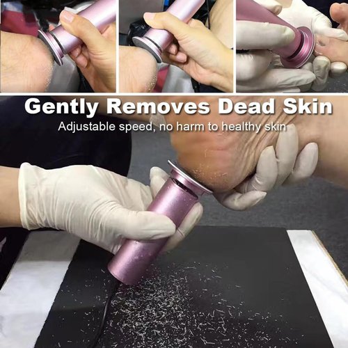 Electric Callus Remover, Ravifun Foot File Grinder Pedicure Tool with Speed Controller and 60pcs Replacement Sandpaper Disk for Men Women Dead Dry Crack Skin Calluses