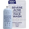 AYADARA Severe Acne Charcoal Face Wash, 3.4 oz, Daily Face Wash with Sulfur and Honey, Charcoal Face Cleanser, Mens Face Wash for Acne, Deep Cleansing Charcoal Face Wash for Women and Men, 200 Uses