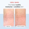 First Aid Beauty Ultra Repair Cream Intense Hydration Moisturizer for Face and Body – Rich Whipped Texture Strengthens Skin Barrier + Instantly Relieves Dry, Distressed Skin + Eczema – 6 oz