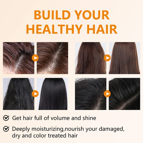 Shampoo Bar Turmeric Soap Bar Shampoo for Hair Clarifying Shampoo Bar Organic Ginger Bar Shampoo for Hair Growth Regrowth Natural Solid Shampoo Bars, Dandruff Shampoo Bar for Thinning Hair Loss 2 Pack