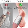 Foot Scrubber with Stand, Never-Cut-Your-Feet Foot File Callus Remover - Safe to Use | Comfortable Foot Scraper Feet Scrubber Dead Skin Remover, Best Home Pedicure Foot Care Tool, Used on Wet/Dry Feet