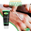 Dr. Dan's Hydrocortisone Hand and Body Lotion - Anti Itch Lotion for Men and Women - 1 Pack