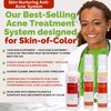 Advanced Acne Treatment & Prevention Serum™ for Skin-of-Color, Reduces Discoloration Breakouts Pores, Benzoyl Peroxide Green Tea 1.7 Oz, Beauty of the Nile®