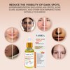 Nasola Kojic Acid Serum for Skin Clarifying, Complexion Revitalization Fade Cream with Alpha Arbutin, Vitamin C & E, & Niacinamide
