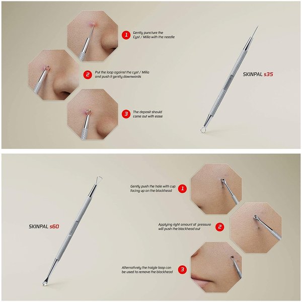 Suvorna Skinpal Pimple Popper Tool Kit | Milia Remover | Lancets for Facial Extraction | Whitehead Extractor Tool | Comedone Extractor | Blackhead Remover Tool | Acne Needle Tool & Cyst Removal Tool.
