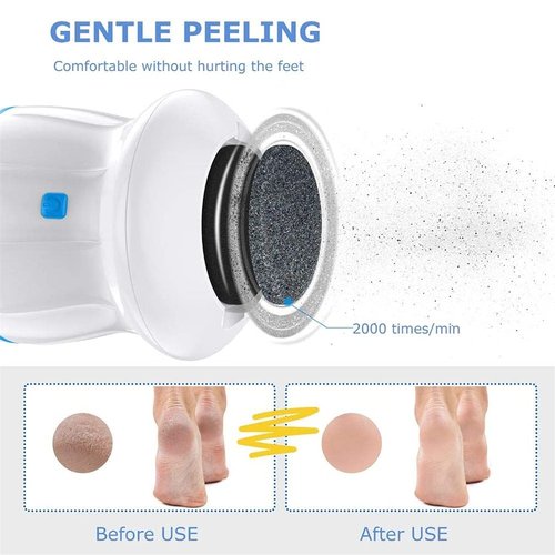Portable Electric Foot Grinder, Electric Foot Callus Remover Electric Vacuum Adsorption Foot Grinder, Foot Heel Repair Electric Foot File Pedicure Foot Care Tool for Dead, Hard Cracked Dry Skin (Blue)