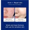 Cystic, Hormonal, Severe Acne Treatment Cream for Teens & Adults with Hyaluronic Acid Aloe Vera Oil Overnight Cystic , Unisex Sensitive Skin Blind Pimple & Blemish Remover (3 PACK)