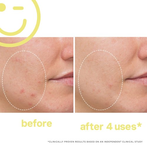 Kate Somerville Mega-C 30% Vitamin C Brightening Facial - Powerhouse Clinic-Grade Brightening Mask, 2 Fl Oz