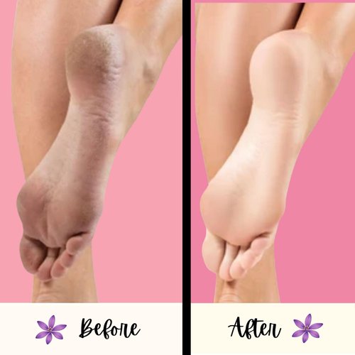 Mr. Pumice Mr. pumice purple pumi bar, extra-coarse callus remover, pedicure stone & ped file scrubber for smooth feet and heels, 6 Count