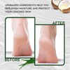 Vebuni Urea Cream 42% Foot Cream Salicylic Acid 4 Oz, Upgraded Callus Remover For Feet, Knees& Elbows, Intensive Moisturizes & Softens Skin, Exfoliates Dead Skin
